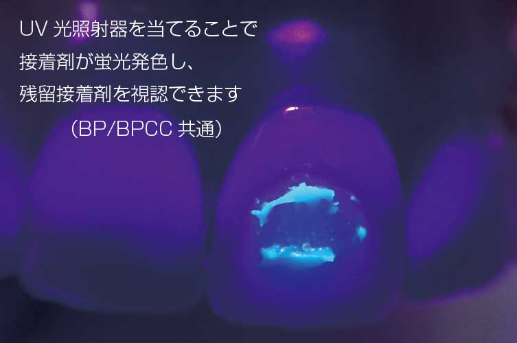 ﾌﾞﾚｰｽﾍﾟｰｽﾄ ｶﾗｰﾁｪﾝｼﾞ BPCC (1本入)