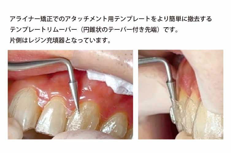 ﾃﾝﾌﾟﾚｰﾄﾘﾑｰﾊﾞｰ ｼﾞｬﾍﾞﾘﾝ