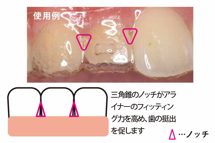 ｸﾗｽﾌﾟﾘﾌﾄ