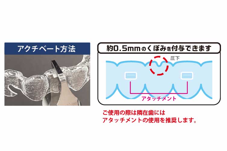 SMｲﾝﾄｩﾙｰｼﾞｮﾝ ﾌﾟﾗｲﾔｰ