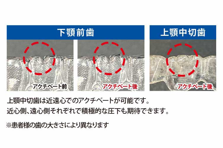 SMｲﾝﾄｩﾙｰｼﾞｮﾝ ﾌﾟﾗｲﾔｰ