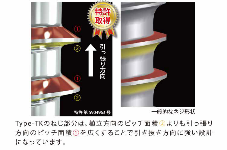 B-max ｽｸﾘｭｰ Type-TK # φ1.6×6mm