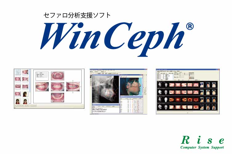 ＜商品紹介用＞WinCeph Ver.11.5