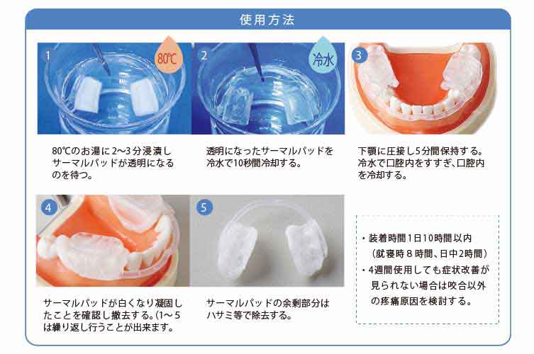 ｱｸｱｽﾌﾟﾘﾝﾄ ｻｰﾓ